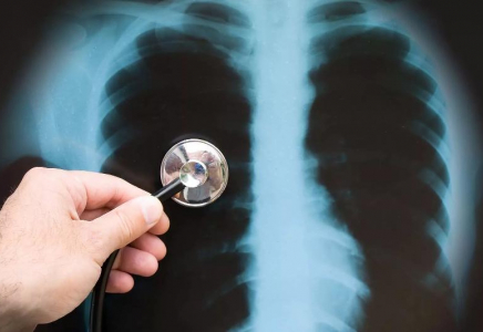 БАӘ-де жаңа типтегі пневмонияға шалдыққан бір адам анықталды