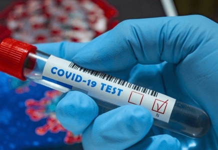 Өткен тәулікте 91 адамнан коронавирус инфекциясы анықталды