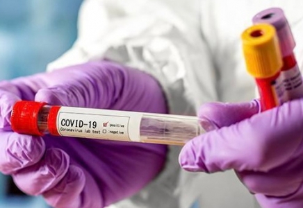 Шымкентте 30 адамнан коронавирус анықталды