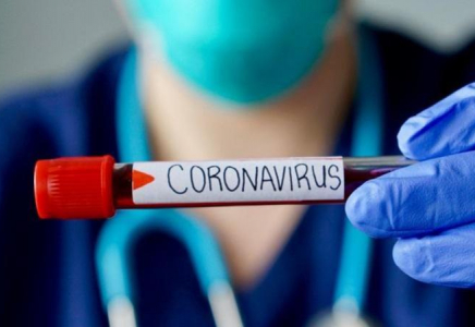 Ғалымдар коронавирусты анықтайтын қағаз тест жасап шығарды