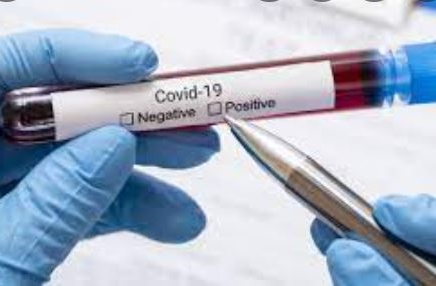 ТҮРКІСТАН: Коронавирустық инфекция аурушаңдығы 2,5 есеге төмендеген