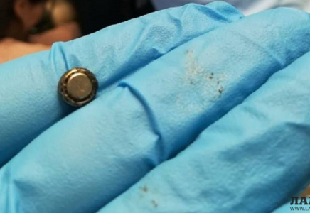 Батарейку изъяли из носа двухлетнего ребенка врачи в Актау