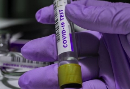 Үндістанда ондаған мың адам коронавирустың жаңа бір түрін жұқтырған