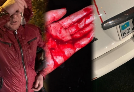 Алматыда «Яндекс» такси жүргізушісі жолаушының қолын тіліп тастаған