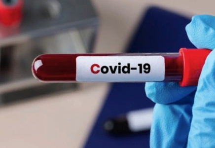 Шымкентте 75 адамнан коронавирус анықталды