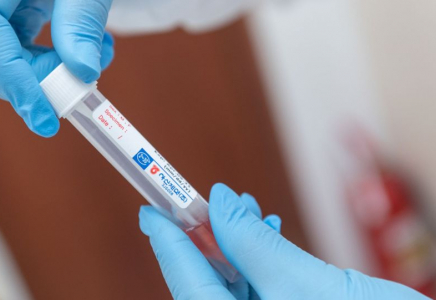 Алматыда сынамалардың 78 процентінен 