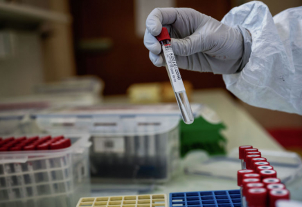 COVID-19: Алматыда вирус жұқтырғандар көбейді 