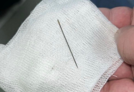 ТҮРКІСТАН: 8 айлық сәбидің іш қуысынан ине табылды