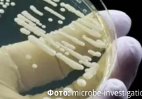 Өте жұқпалы вирус әлемге қауіп-қатер тудырып тұр