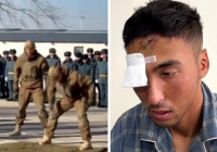 Жамбыл облысында әскери қызметкер басына шыны бөтелке жарып, бір көзінен айырылды