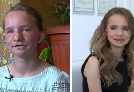 Туыстары келбетін жарақаттаған алматылық қыз адам танымастай өзгерді