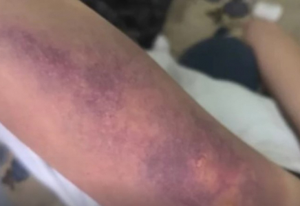 Қарағандыда бір топ жасөспірім қыз баланы соққыға жықты 