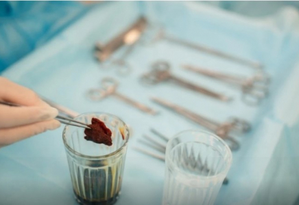 ШҚО-да үйде сүндеттелген бірнеше бала ауруханаға түсті 