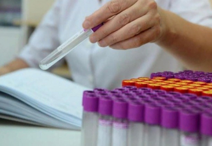 Елімізде коронавирустан жазылғандар саны 885 мыңнан асты  