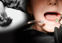 Астанада стоматолог 3 жасар қыздың 18 тісін бірден емдемек болған: бүлдіршін көз жұмды