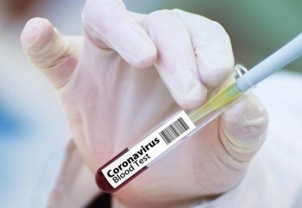 Елімізде бір тәулікте 72 адамнан коронавирус анықталды  