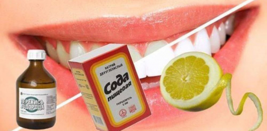 ​Тісіңіз САРҒЫШ па? АҒАРТУҒА болады