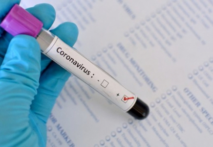 Өткен тәулікте тағы 7 792 адам коронавирус жұқтырды