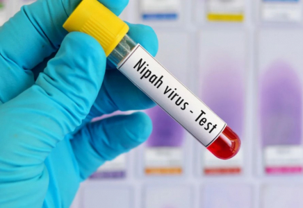 Елімізде Нипах вирусына байланысты шекарадағы санитариялық бақылау күшейді