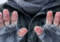 Павлодарда қатты аяздан 16 адам саусағынан айырылды