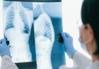 ​Өкпе эхинококкозы - жануарлардан, жуылмаған тағам немесе су арқылы жұғады