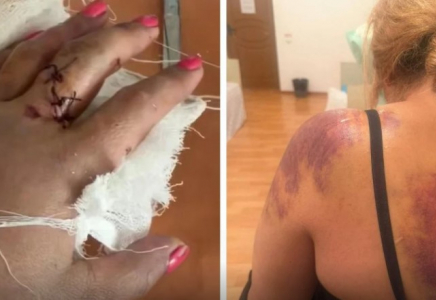 Жетісу облысында ер адам әйелді күрекпен аяусыз соққыға жықты 