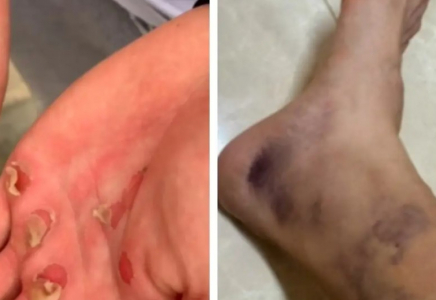 Қол-аяғы көгеріп, әбден қиналған: Дубайда жарысқа қатысқан қазақ қызы қандай қиындықтан өткенін көрсетті (ВИДЕО)