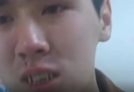 Әскердегі соққы: Жақ сүйегі сынған сарбазды туыстарынан жасырған 