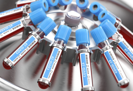 Алматыда коронавирусты анықтайтын бірнеше зертхана істен шықты