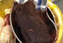 ТҮРКІСТАН: 15 жастағы қыздың ішінен 1 келі шаш шықты