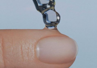 ​Тырнақтың айналасындағы ТЕРІ «жалбырап» кете бере ме?